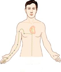 Pericardium Meridian
